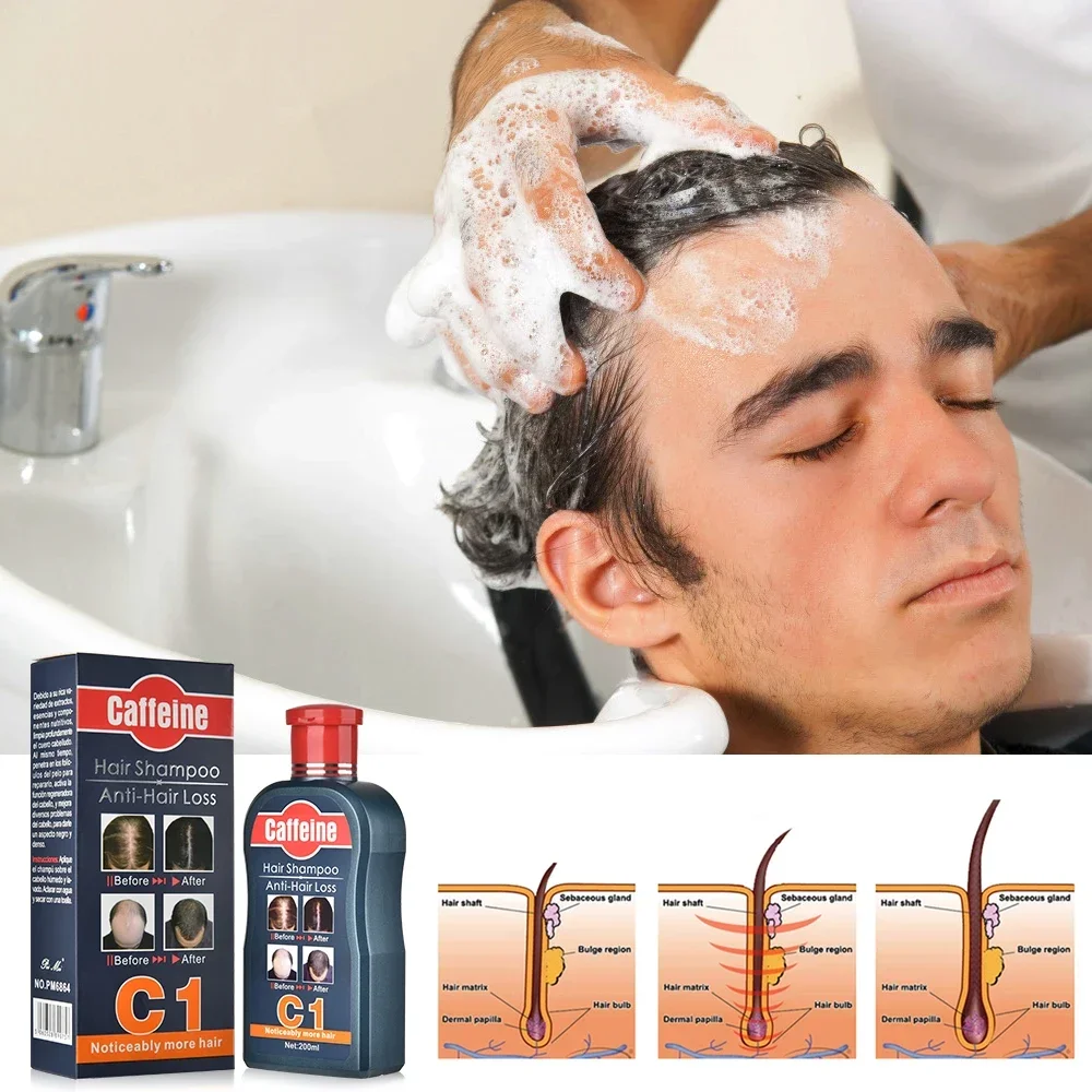 Men Shampoo For Hair Growth Na - Hair Care Korean Products recension och pris