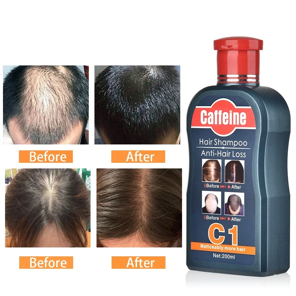 Men Shampoo For Hair Growth Na - Hair Care Korean Products recension och pris